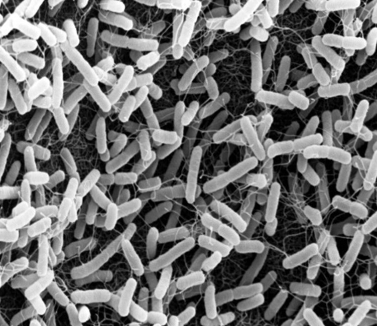 Image of bacteria under a microscope