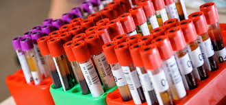 Blood Specimens Awaiting Testing